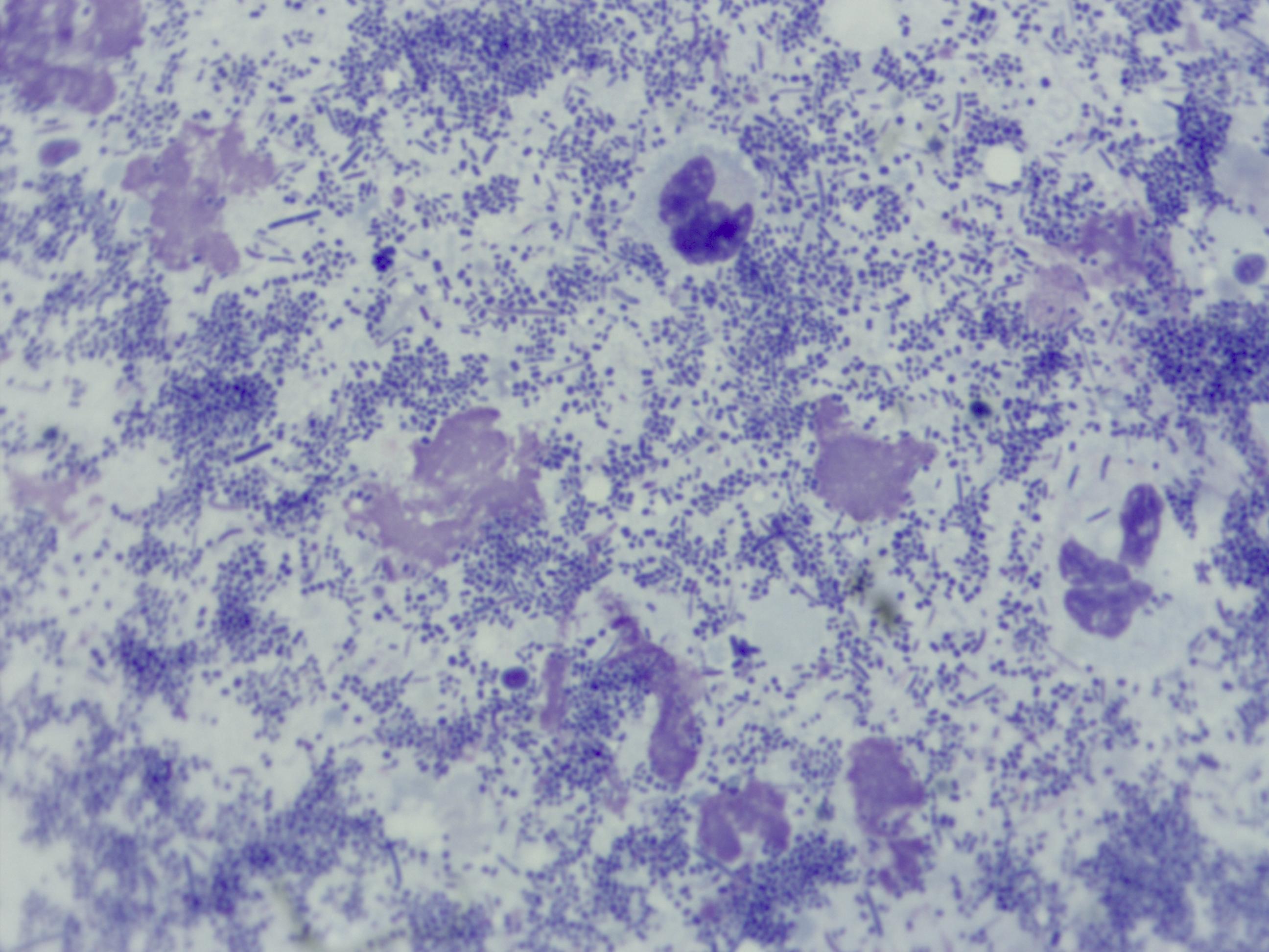 Diagnostics - Cytology 2 - Bacteria TNTC