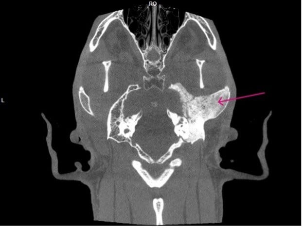 Dog Ear Sign Radiograph Ear Disease and Video Otoscopy | Animal Dermatology Group
